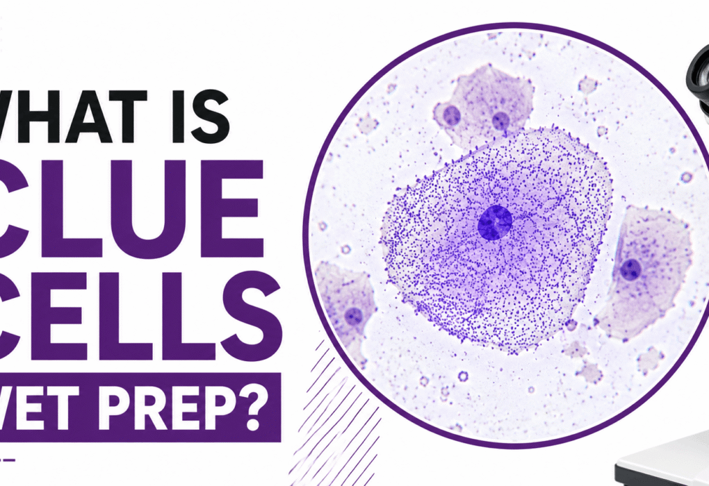 What Are Clue Cells in a Wet Prep