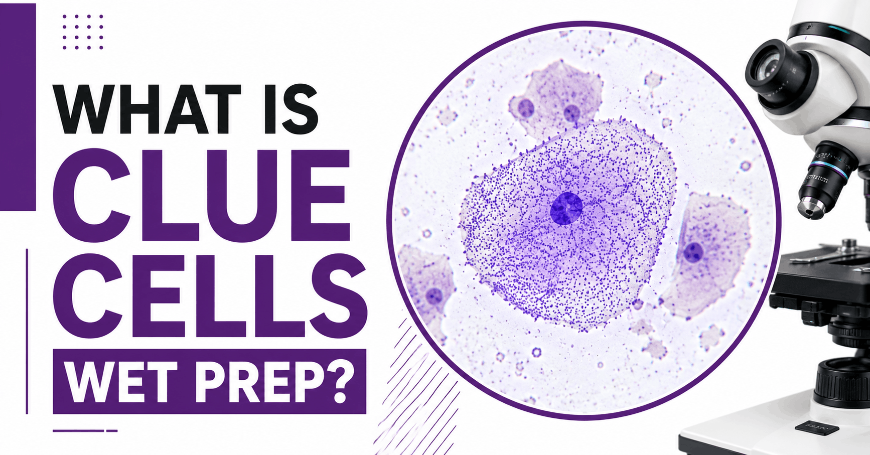 What Are Clue Cells in a Wet Prep